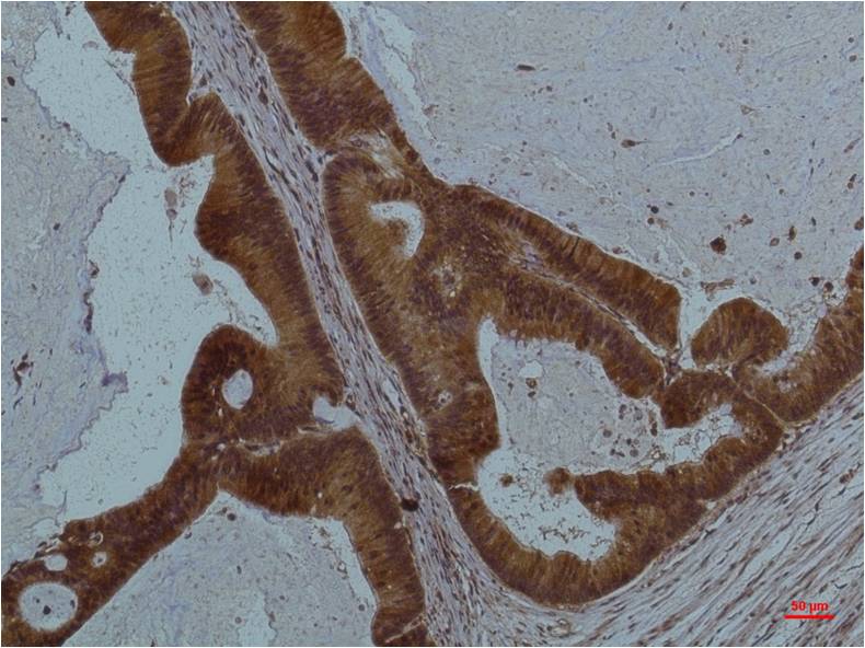 STAT3 (6H10) Mouse mAb ABZ3973