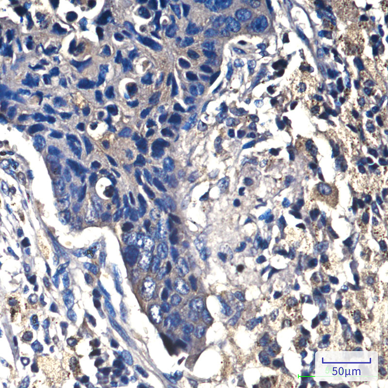beta Catenin Mouse mAb ABZ3980