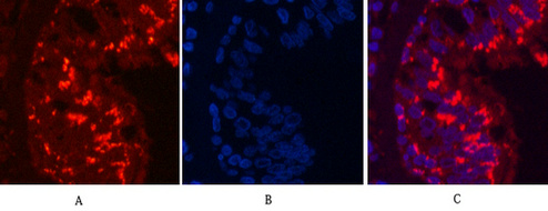 CD68 (9H5) Mouse mAb ABZ3983