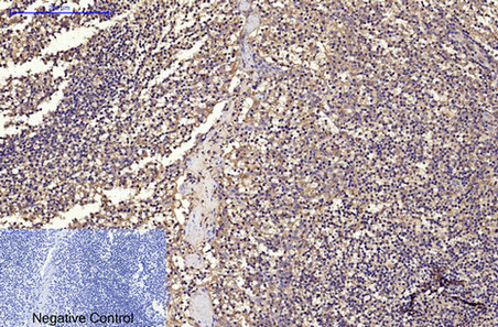 CD68 (9H5) Mouse mAb ABZ3983
