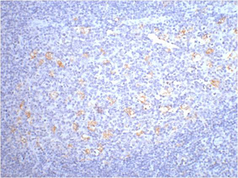 CD68 (9H5) Mouse mAb ABZ3983