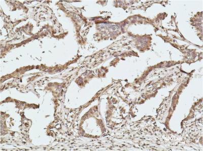 Histone H2B (7E2) Mouse mAb ABZ3984