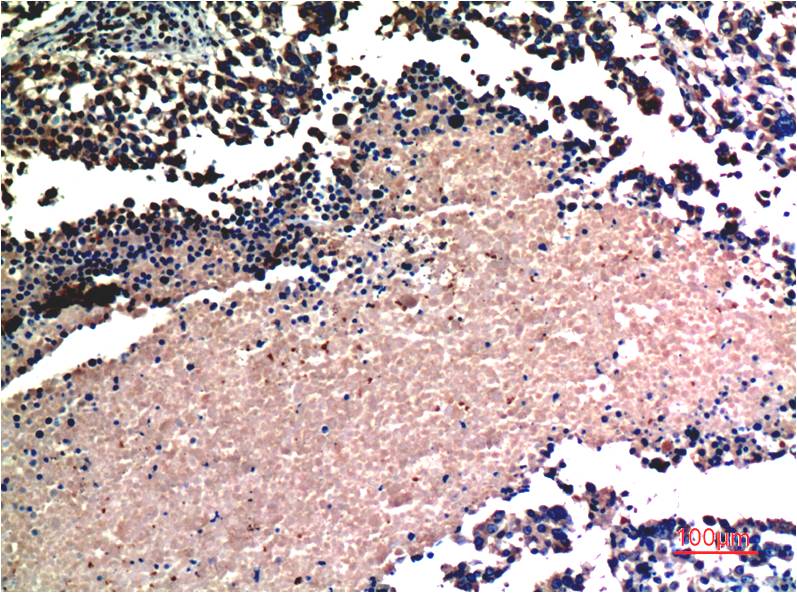 AKT1 (2A1) Mouse mAb ABZ3985