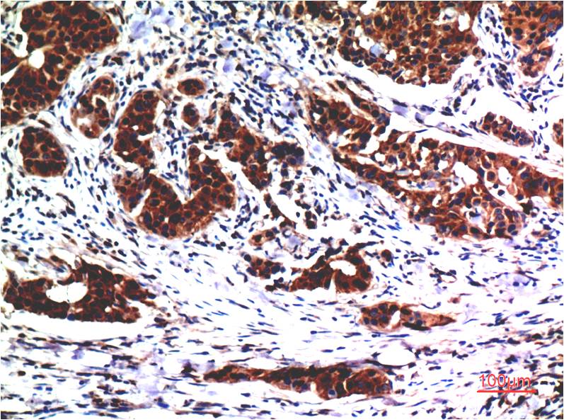 AKT1 (2A1) Mouse mAb ABZ3985