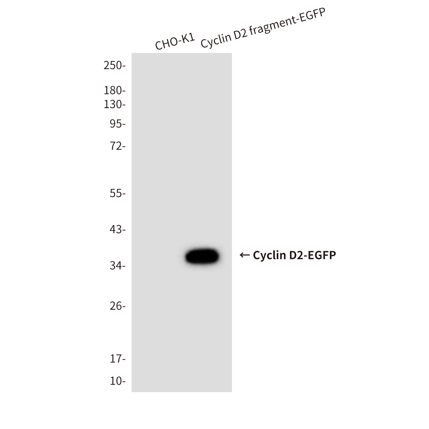 Cyclin D2 (6E11) Mouse mAb ABZ3988