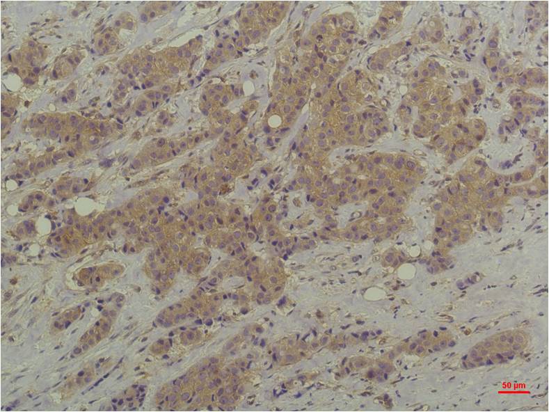 ERK1/2 (9A4) Mouse mAb ABZ3992