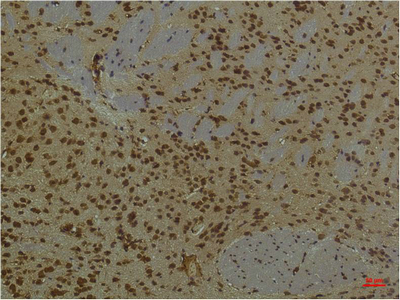 PI3 Kinase p85 alpha (3H5) Mouse mAb ABZ3995