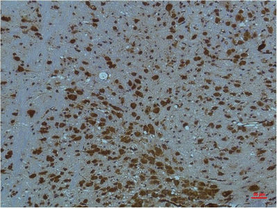 PI3 Kinase p85 alpha (1C8) Mouse mAb ABZ3996