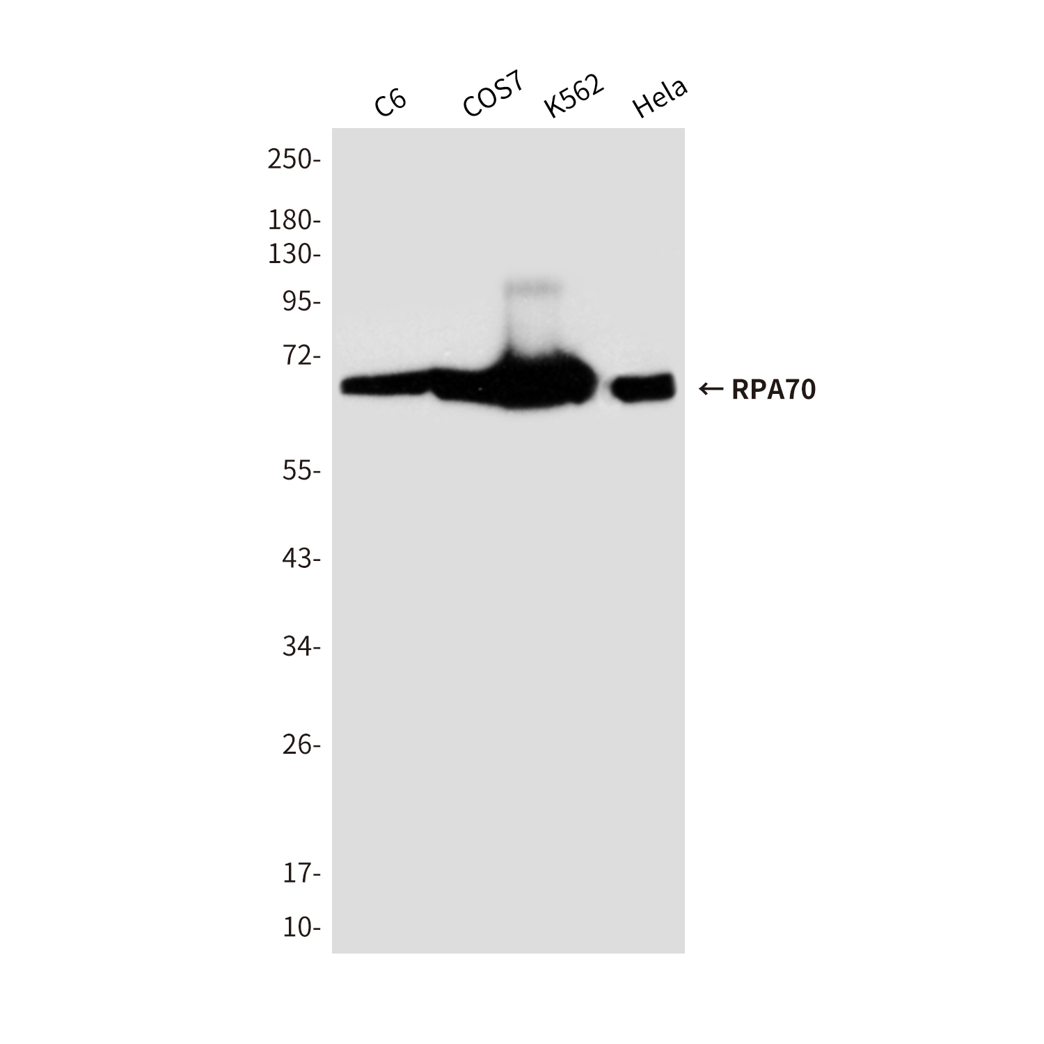 RPA70 Mouse mAb ABZ3998