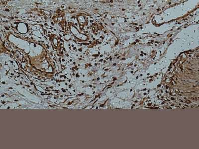 Galectin 3 (7G9) Mouse mAb ABZ4004