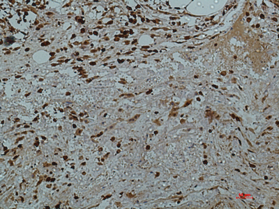 Galectin 3 (7G9) Mouse mAb ABZ4004