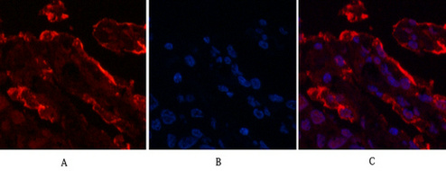 Galectin 3 (4B2) Mouse mAb ABZ4005