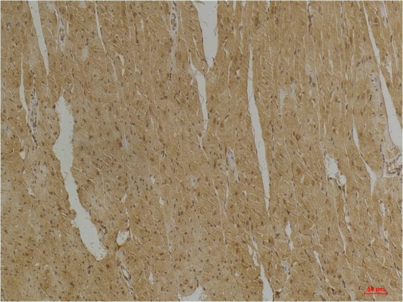 Desmin (4H1) Mouse mAb ABZ4007