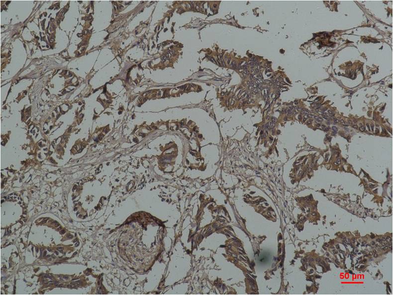 Hsp27 (9G1) Mouse mAb ABZ4010