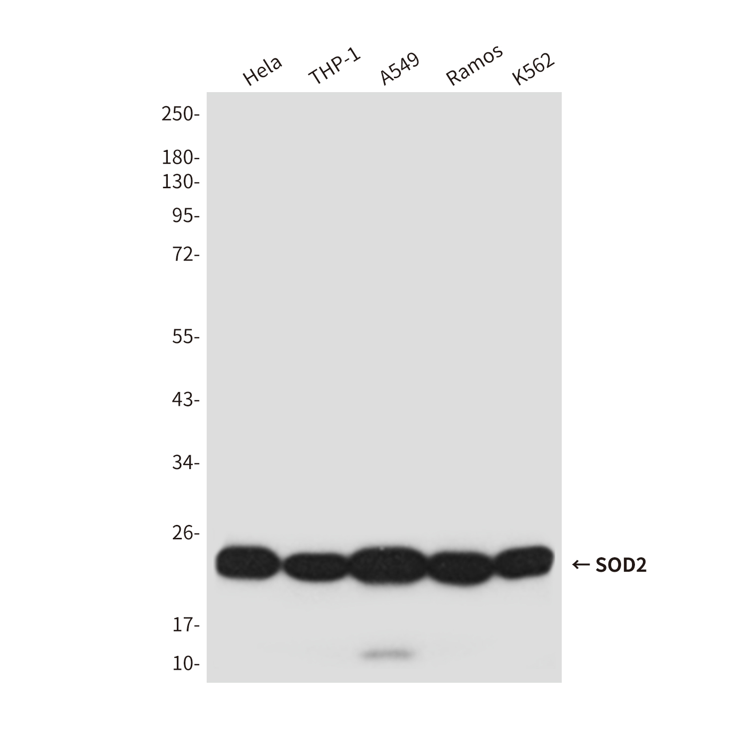 SOD2 (4C4) Mouse mAb ABZ4014