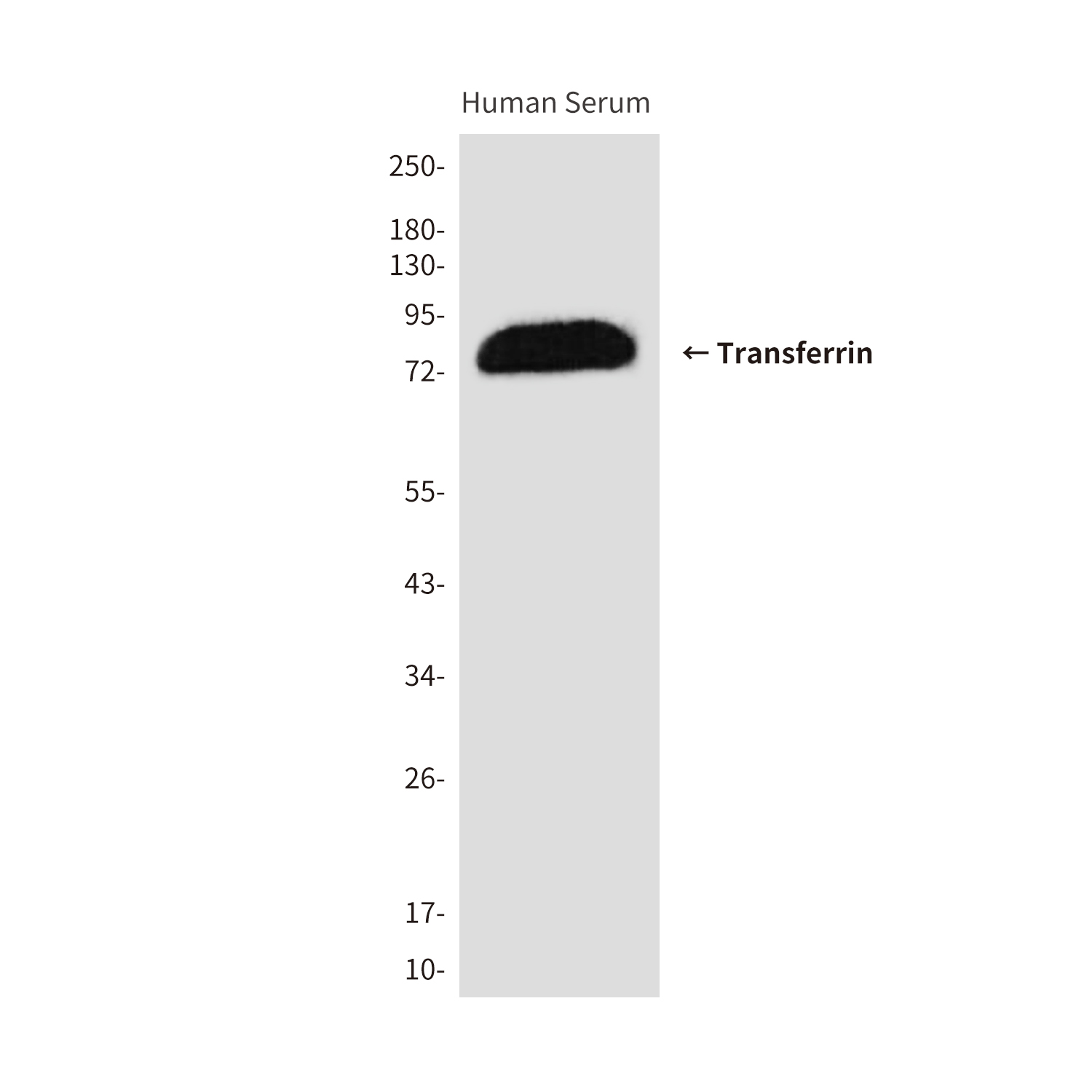 Transferrin Mouse mAb ABZ4016