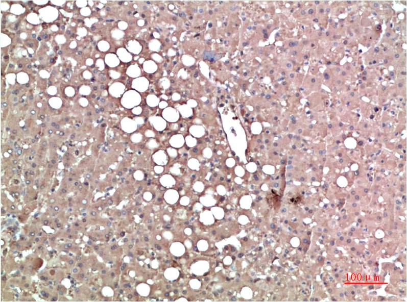 Prealbumin (1F6) Mouse mAb ABZ4020