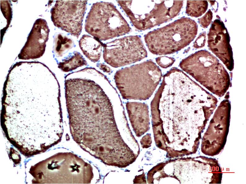 Prealbumin (1F6) Mouse mAb ABZ4020