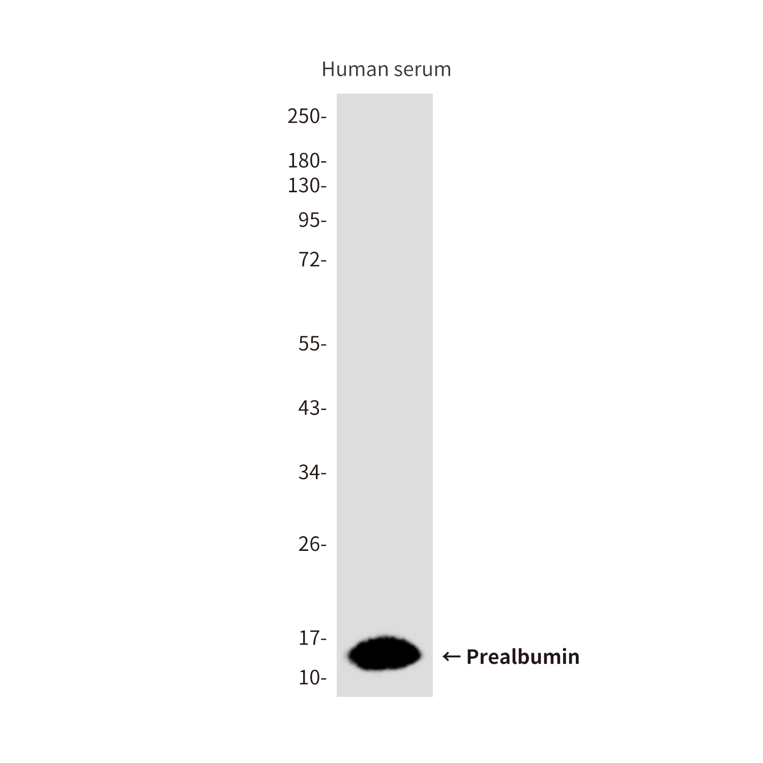 Prealbumin (1F6) Mouse mAb ABZ4020