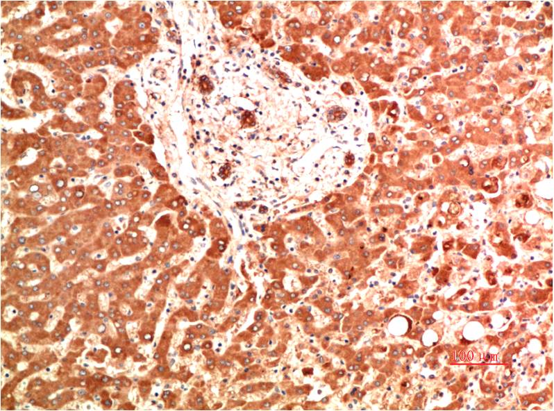 Collagen IV alpha 1 (2G3) Mouse mAb ABZ4025