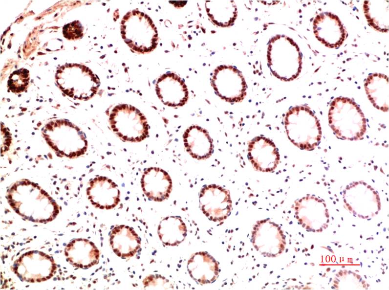 Collagen I alpha 1 Mouse mAb ABZ4026