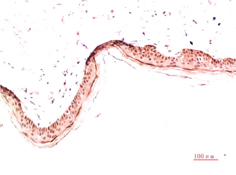 Collagen I alpha 1 Mouse mAb ABZ4026