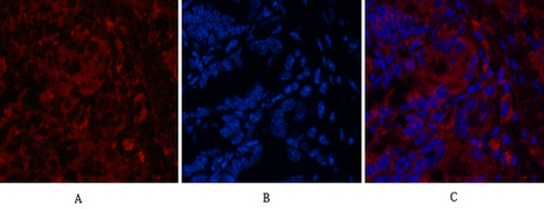 CD4 (7H9) Mouse mAb ABZ4028