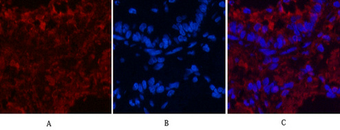 CD4 (7H9) Mouse mAb ABZ4028