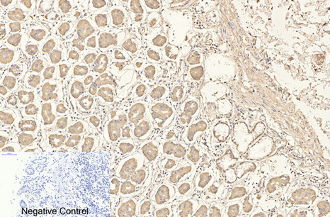 CD4 (7H9) Mouse mAb ABZ4028