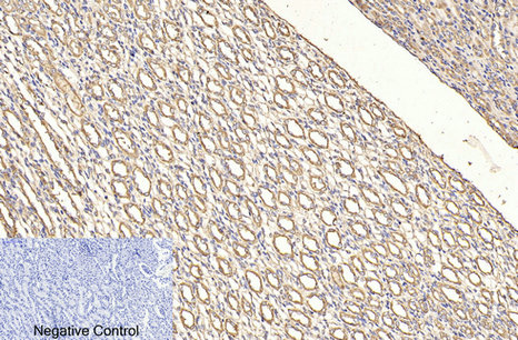 CD4 (7H9) Mouse mAb ABZ4028