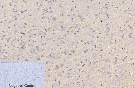 CD4 (7H9) Mouse mAb ABZ4028