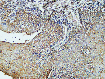 CD4 (7H9) Mouse mAb ABZ4028