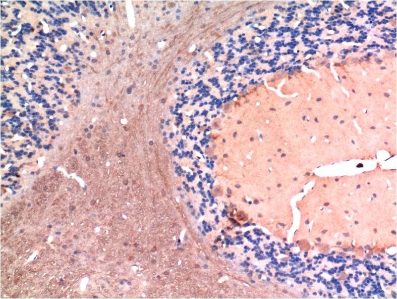 TGF beta 1 (7C9) Mouse mAb ABZ4032