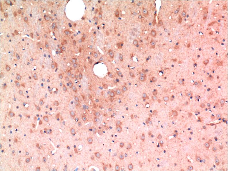 TGF beta 1 (4C1) Mouse mAb ABZ4033