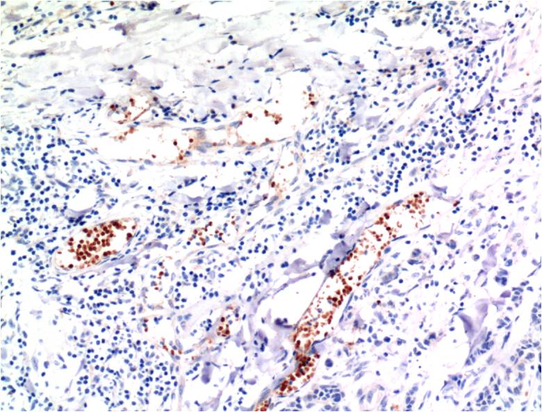 TGF beta 1 (4C1) Mouse mAb ABZ4033