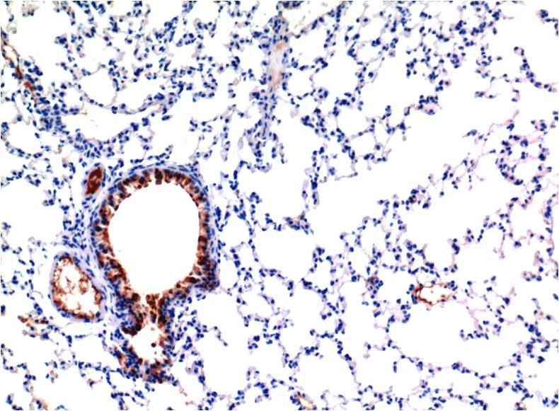 TGF beta 1 (4C1) Mouse mAb ABZ4033
