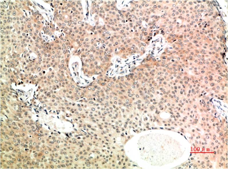 TGF beta 1 (8F6) Mouse mAb ABZ4034
