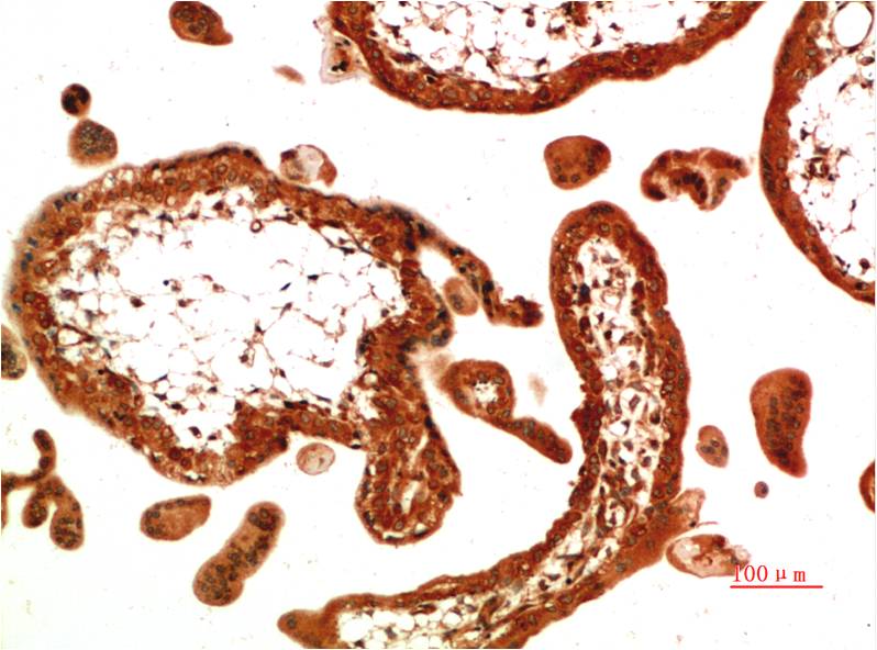 TGF beta 1 (8F6) Mouse mAb ABZ4034