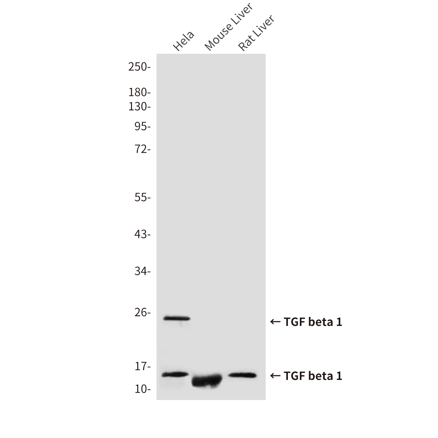TGF beta 1 (8F6) Mouse mAb ABZ4034