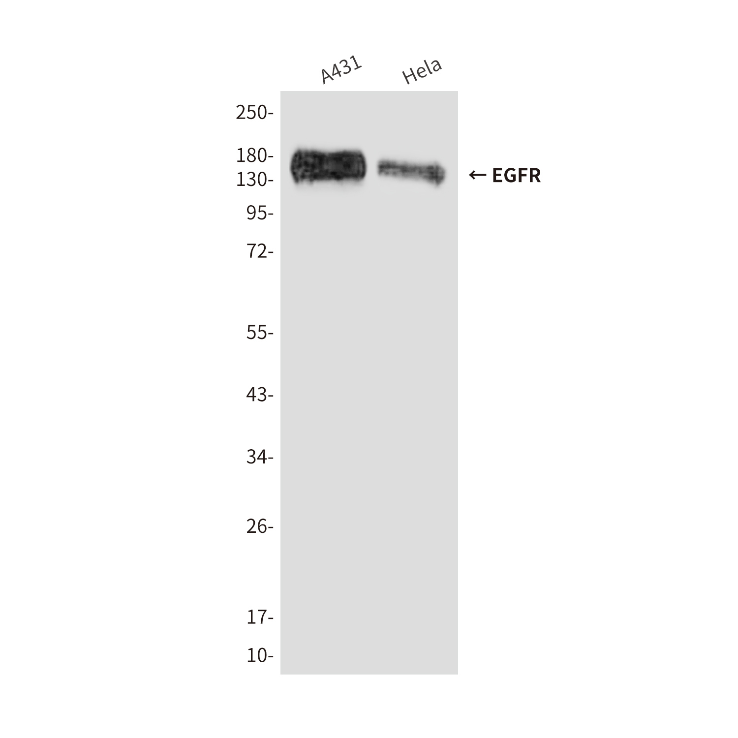 EGFR (5E9) Mouse mAb ABZ4042