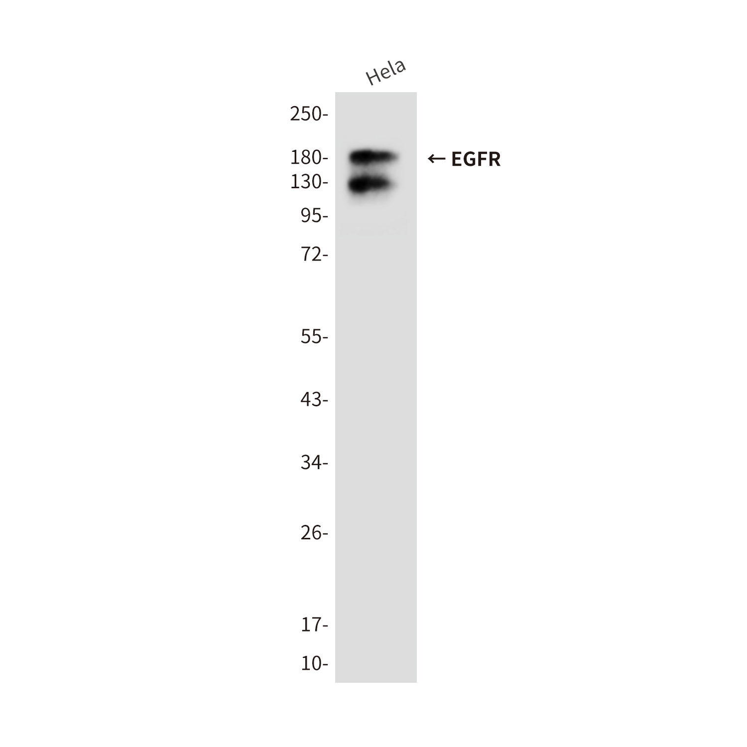 EGFR (5E9) Mouse mAb ABZ4042