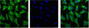 EGFR (3A9) Mouse mAb ABZ4043