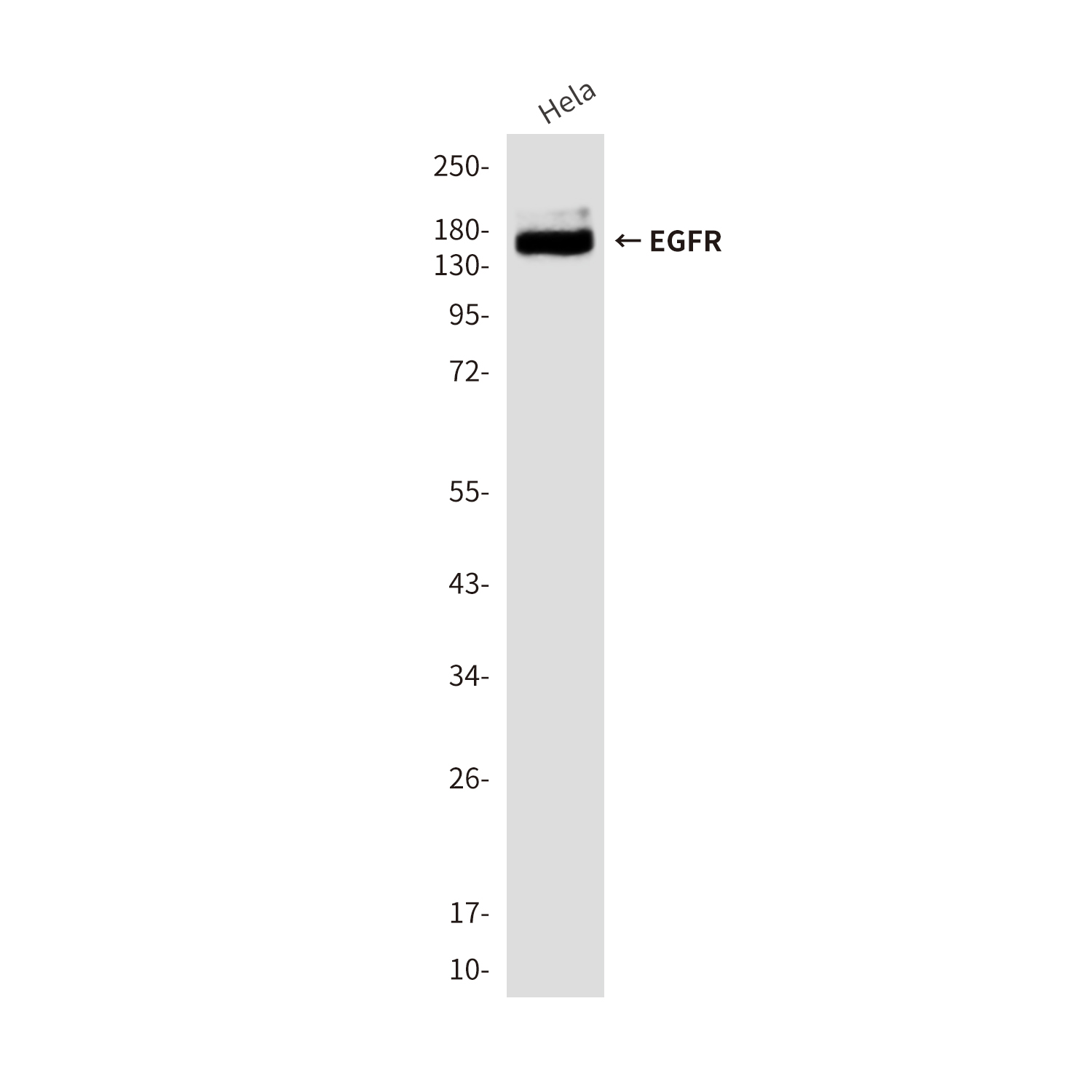 EGFR (3A9) Mouse mAb ABZ4043