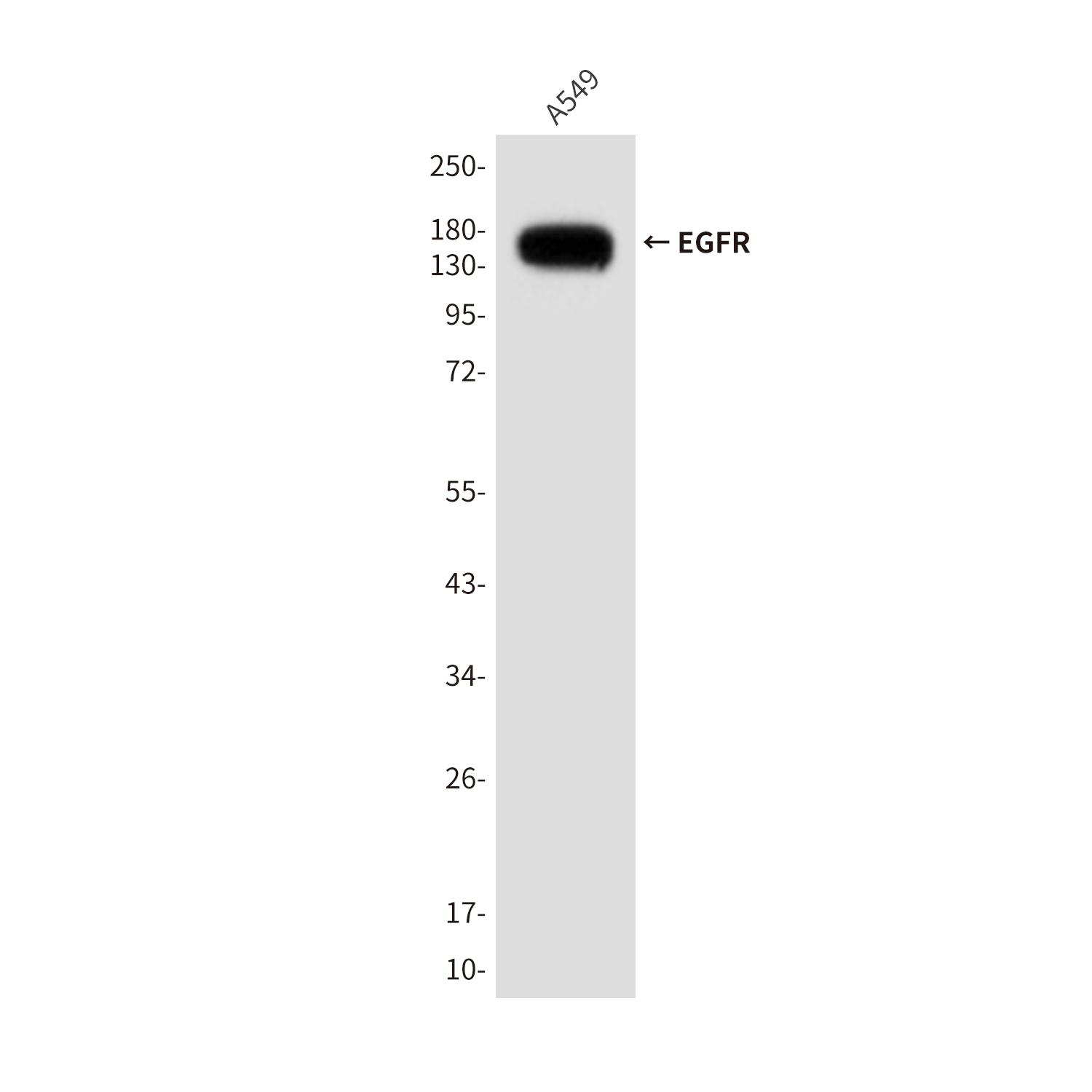 EGFR (1A11) Mouse mAb ABZ4044