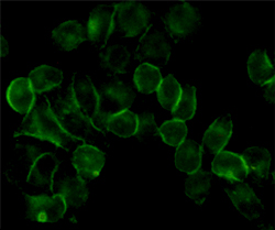 EGFR (5E10) Mouse mAb ABZ4045