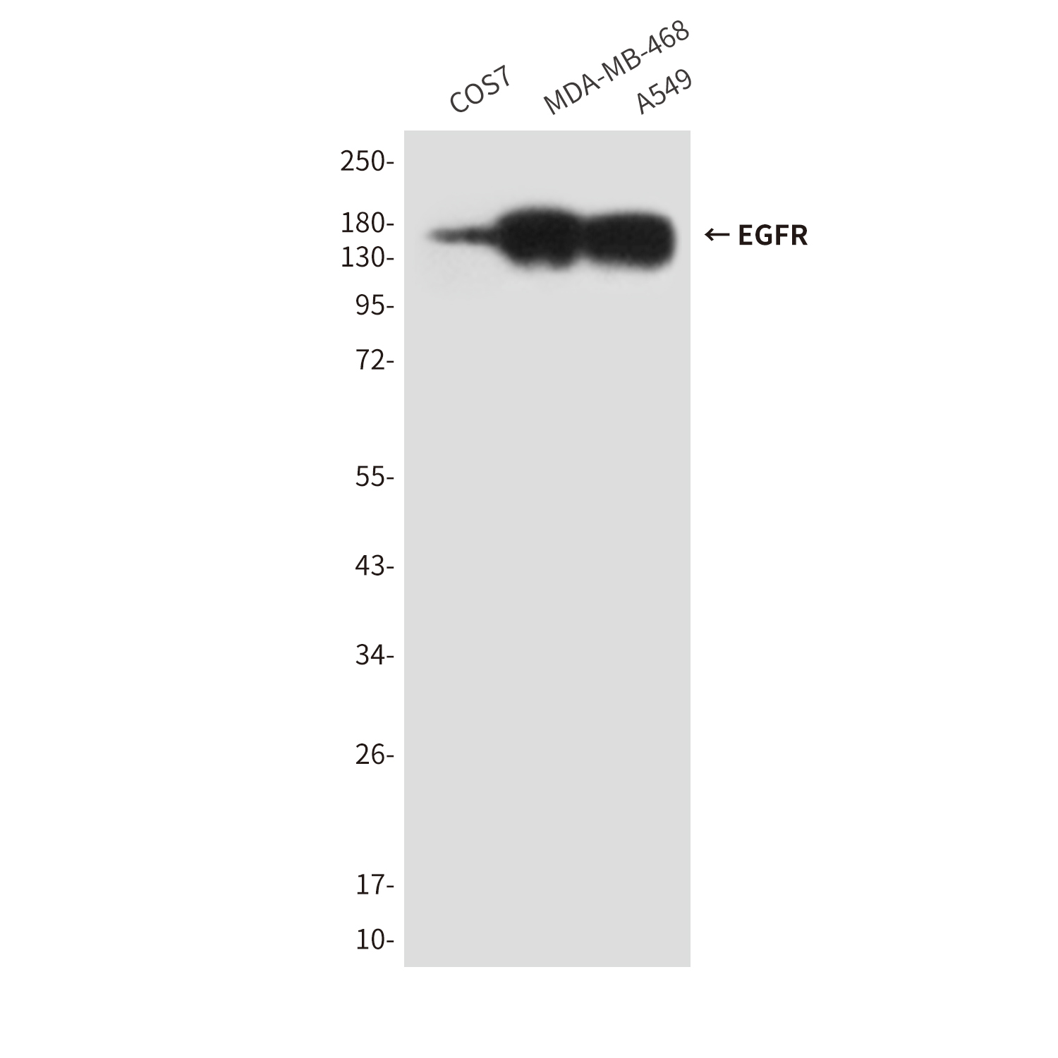 EGFR (5E10) Mouse mAb ABZ4045