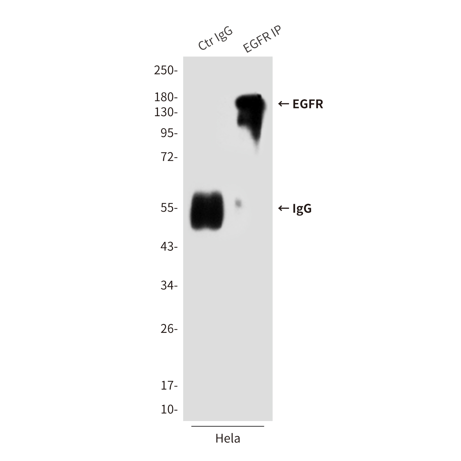 EGFR (6H11) Mouse mAb ABZ4046