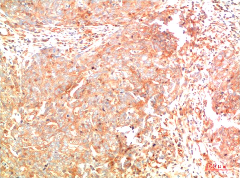 ATG7 (1F8) Mouse mAb ABZ4048
