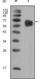 FGFR4 Mouse mAb ABZ4057