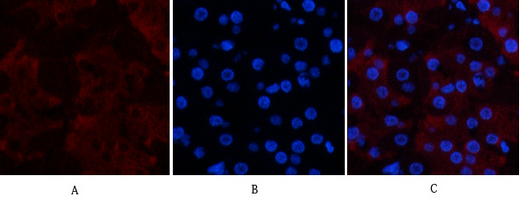 CD23 (3D1) Mouse mAb ABZ4059